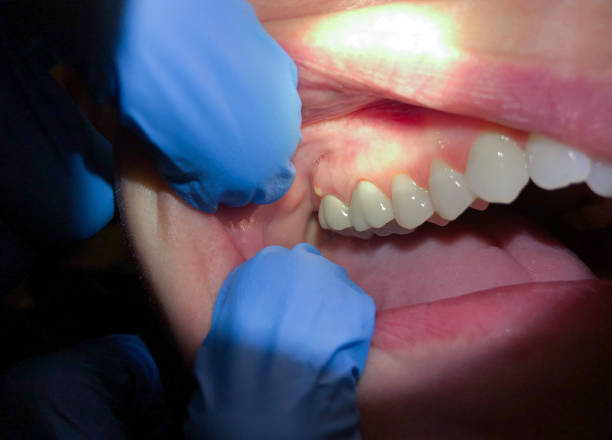 Dentist for Dental Trauma in AR
